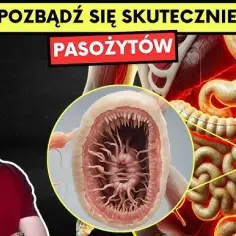  Pozbądź się pasożytów z organizmu domowymi sposobami | Oczyszczanie i detoksykacja